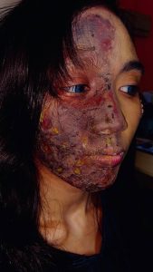 special-effect-makeup-burn-effect